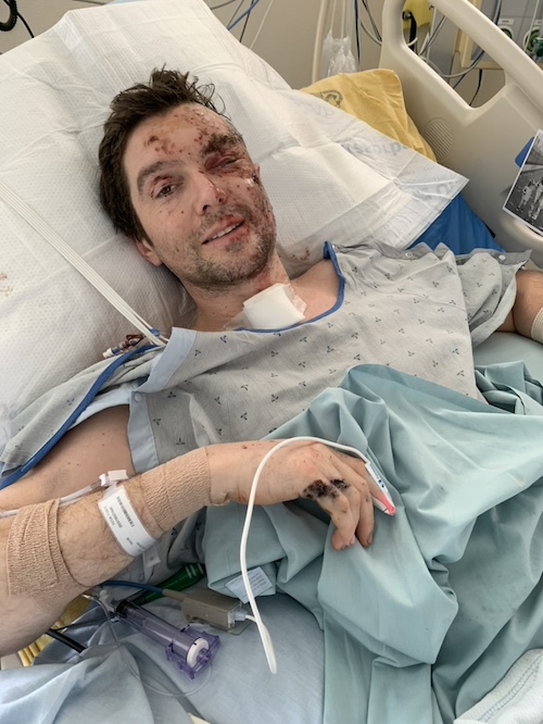 Jesus Calling podcast 466 featuring Benjamin Hall - shown here recovering in the hospital from the Ukrainian War